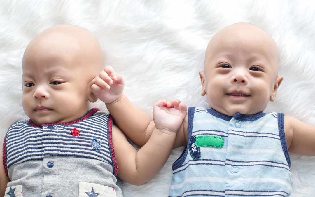 Photo of twin babies with tips to tell twins apart from postpartum doulas in dc, md, va