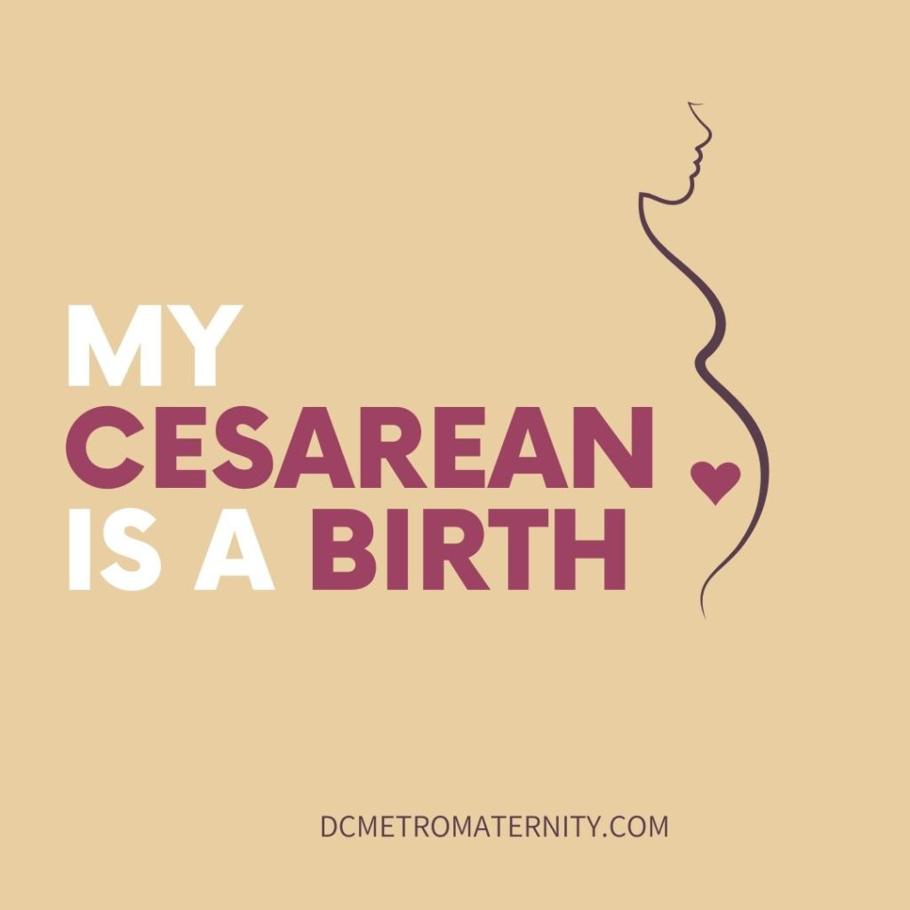 affirmation for c-section from labor doula